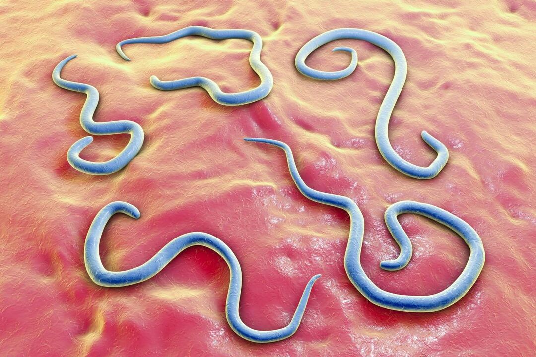 cacing parasit di dalam tubuh manusia