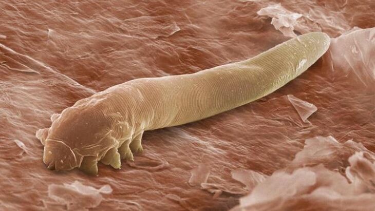 Cacing yang hidup di bawah kulit manusia