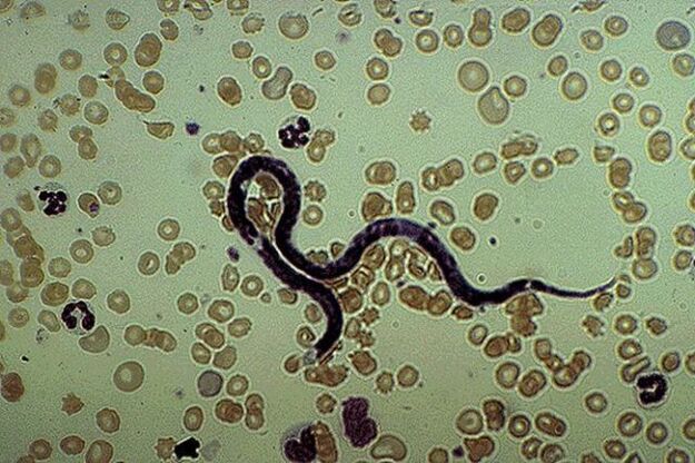 parasit subkutaneus Filaria