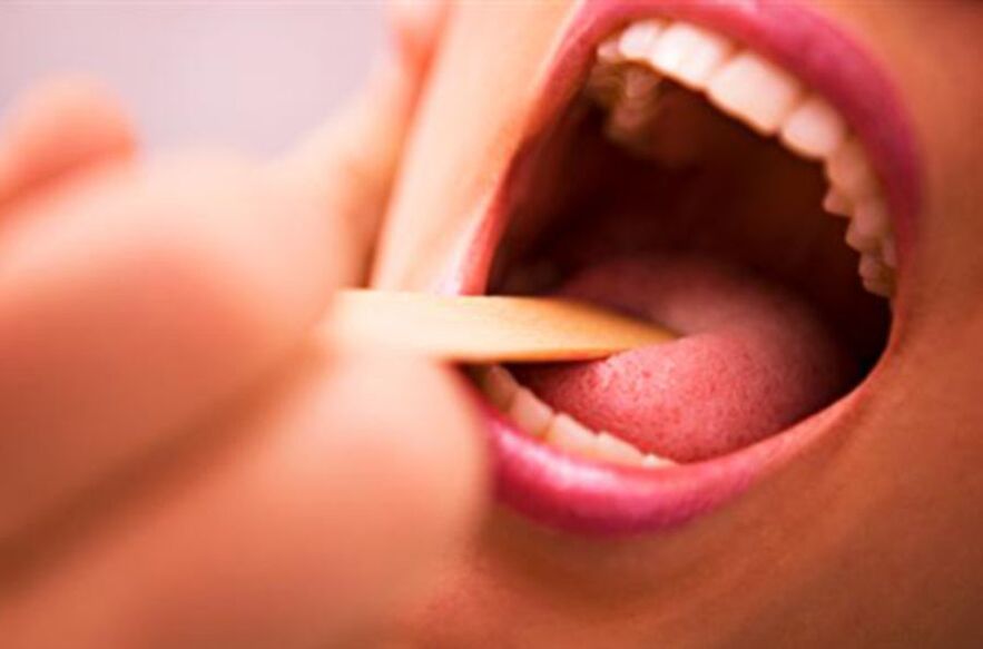 Jenis parasit dalam mulut manusia